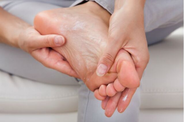 V počátečních fázích plísně nehtů na nohou pomohou antimykotické krémy a kapky