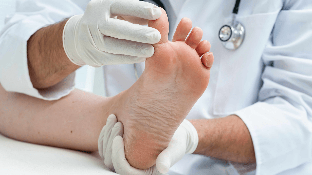 vyšetření kůže nohou na schůzce s odborníkem