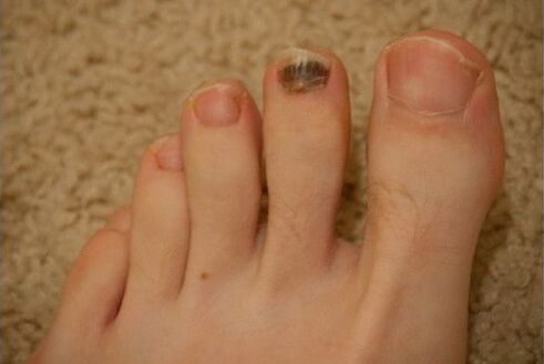 Použití perorálních a topických léků