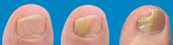 Proces vývoje houby