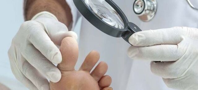 Vyšetření před zahájením léčby plísní