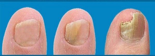 proces vývoje houby